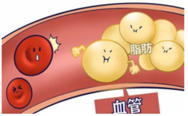 神经酸帮助降血脂
