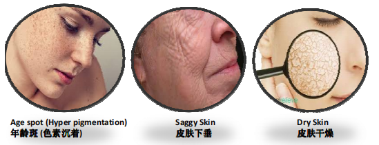 老化过程