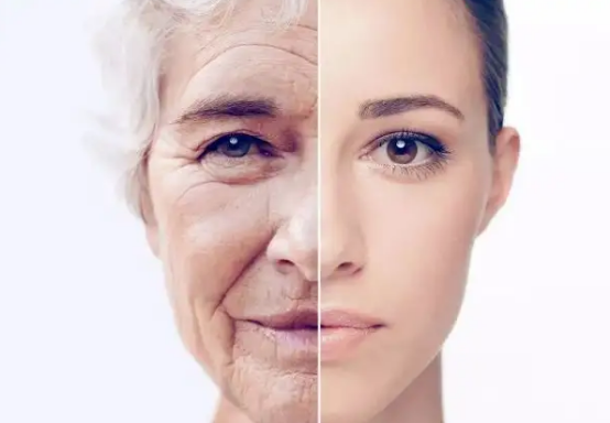 photoaging.